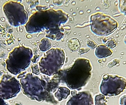 Mikroskopaufnahme: dunkle, violette Partikel und runde Zellen auf hellem Hintergrund.